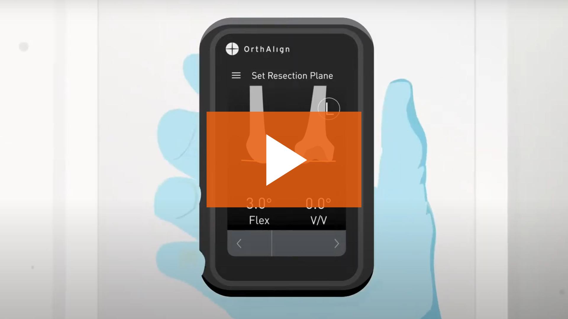 orthalign 3d healthcare marketing video